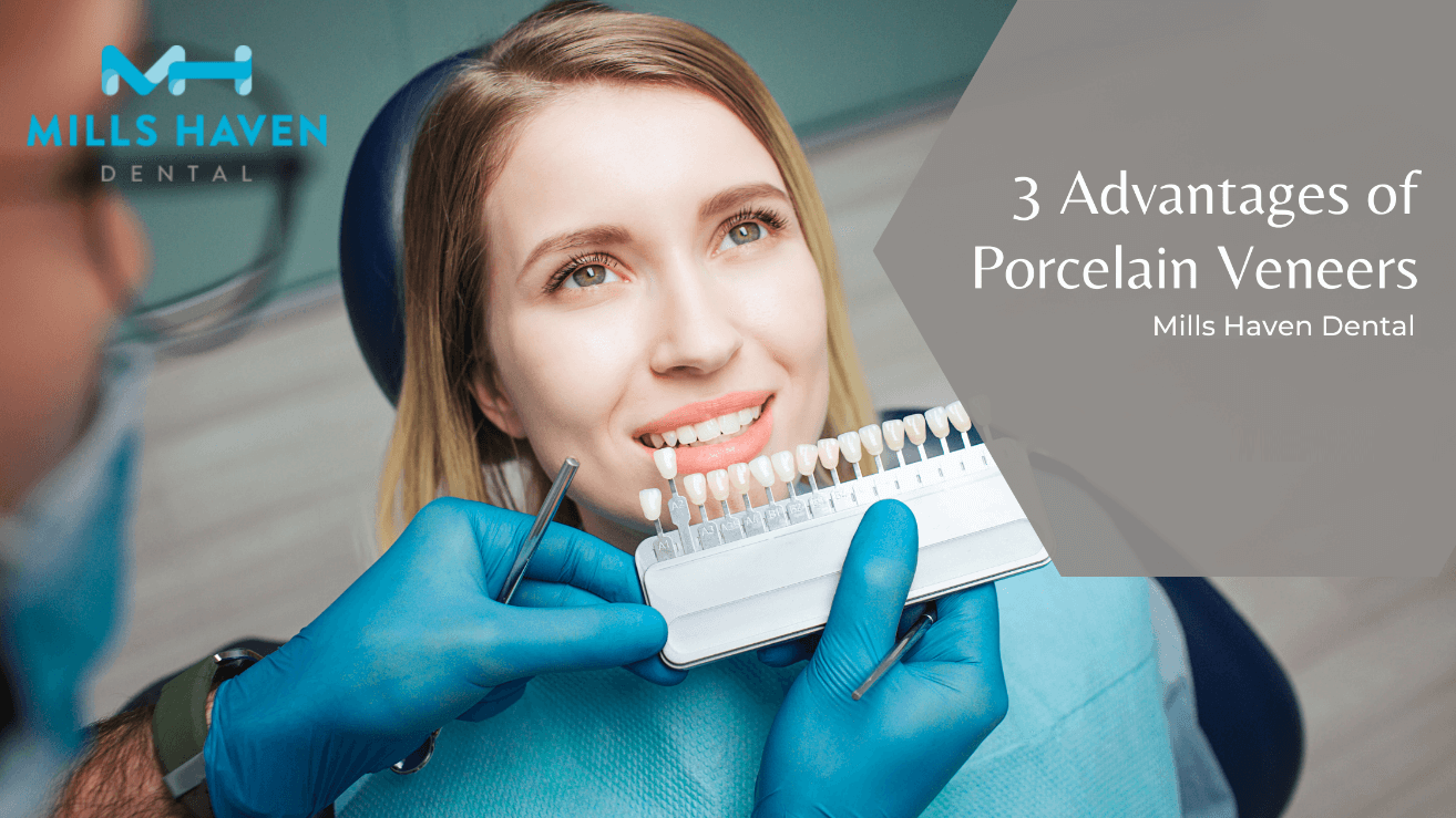 3 Advantages of Porcelain Veneers - Mills Haven Dental