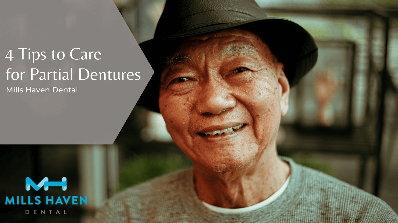 4 Tips to Care for Partial Dentures - Mills Haven Dental