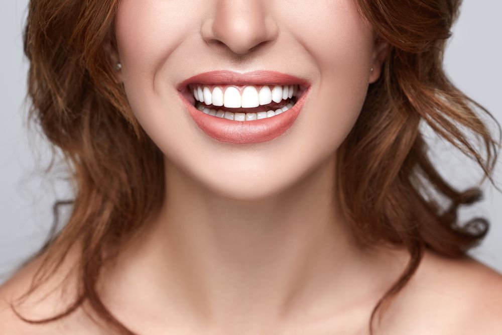 Teeth Whitening - Mills Haven Dental