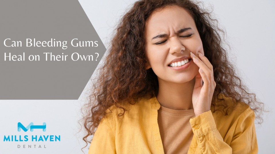 Bleeding Gums - Mills Haven Dental