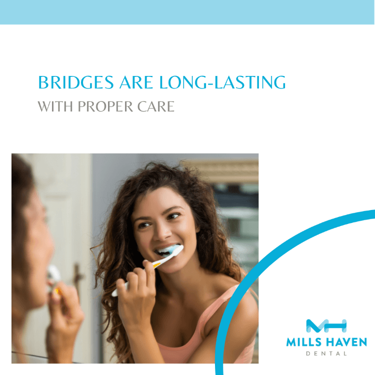 Do dental bridges last