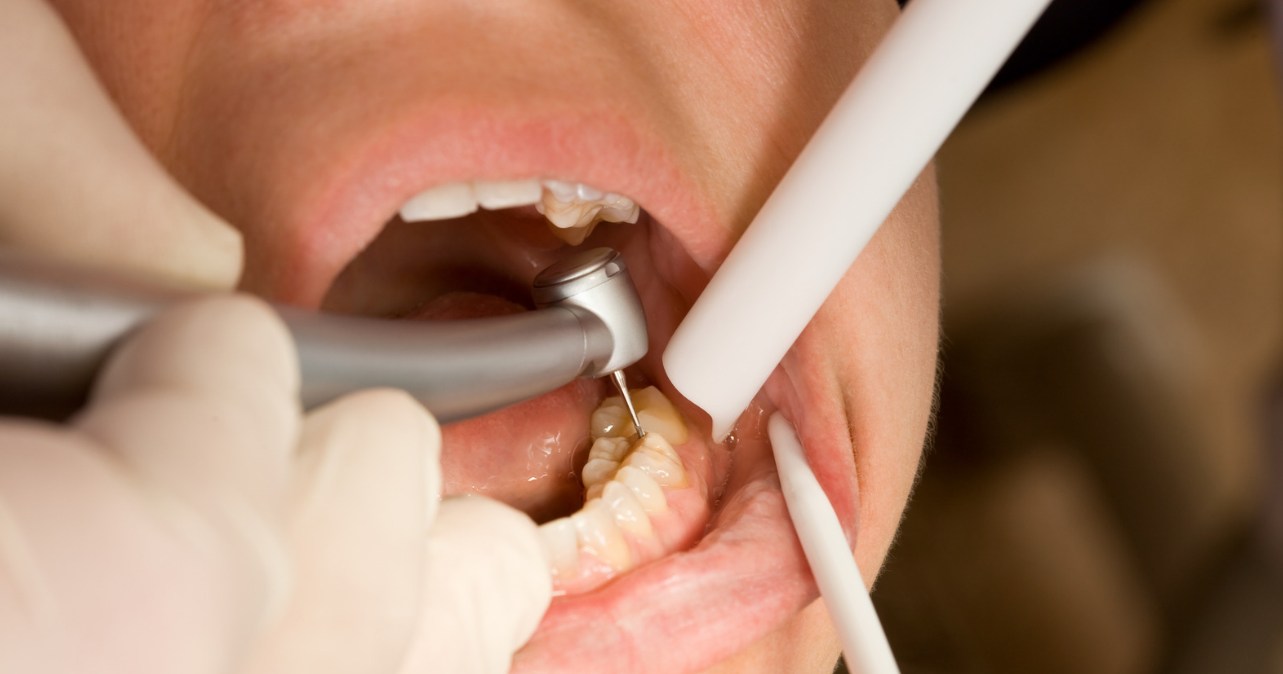 Cracked Tooth, Lost Filling, or Just Sore? A Sherwood Dentist's Guide to What's Actually a Dental Emergency