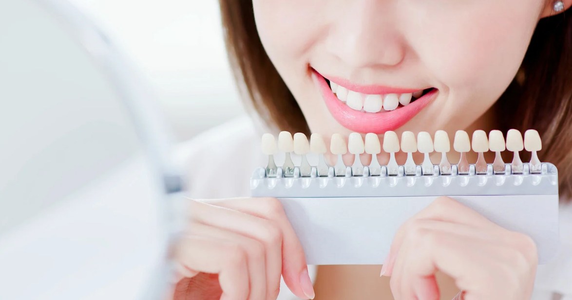 How Long Does Teeth Whitening Last? Tips to Prolong Your Results - A Guide by Mills Haven Dental
