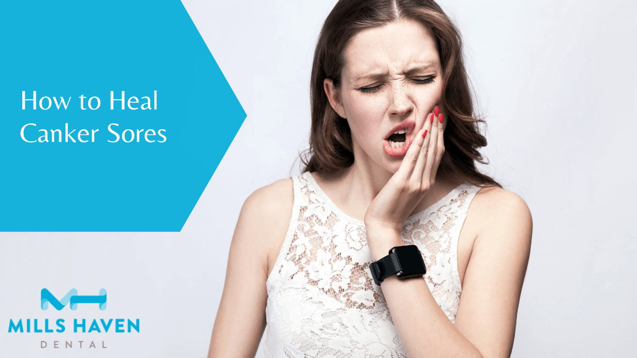 How to Healh Canker Sores - Mills Haven Dental