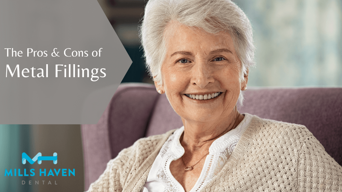 The Pros and Cons of Metal Fillings - Mills Haven Dental