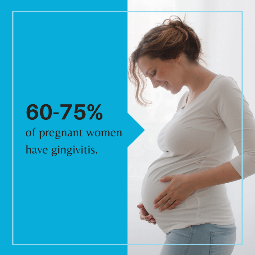 60-75% of pregnant women have gingivitis