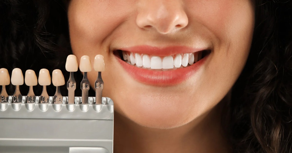 Smile Makeover Options: Finding the Right Treatment for You - A Guide by Mills Haven Dental