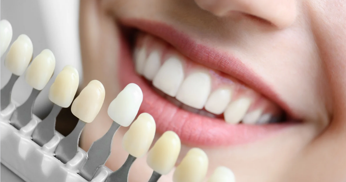 Teeth Whitening Options for a Brighter Holiday Smile - Mills Haven Dental