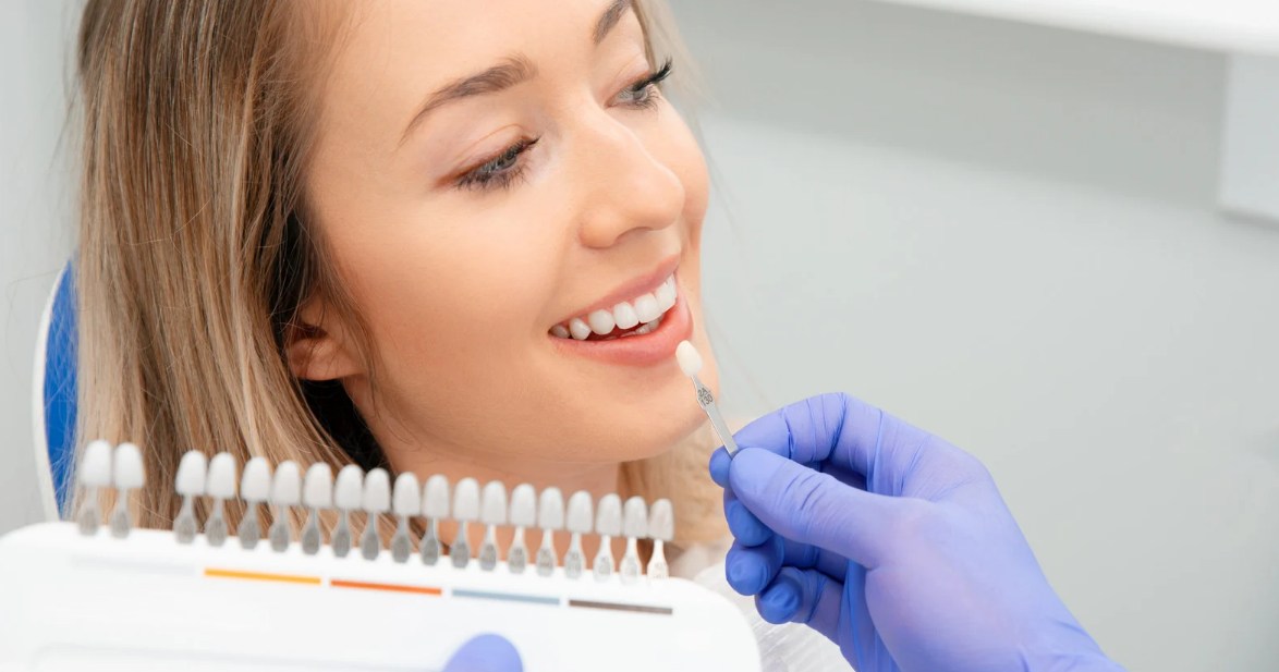 Veneers vs. Bonding: Which Cosmetic Solution Is Right for You? - A Guide by Mills Haven Dental