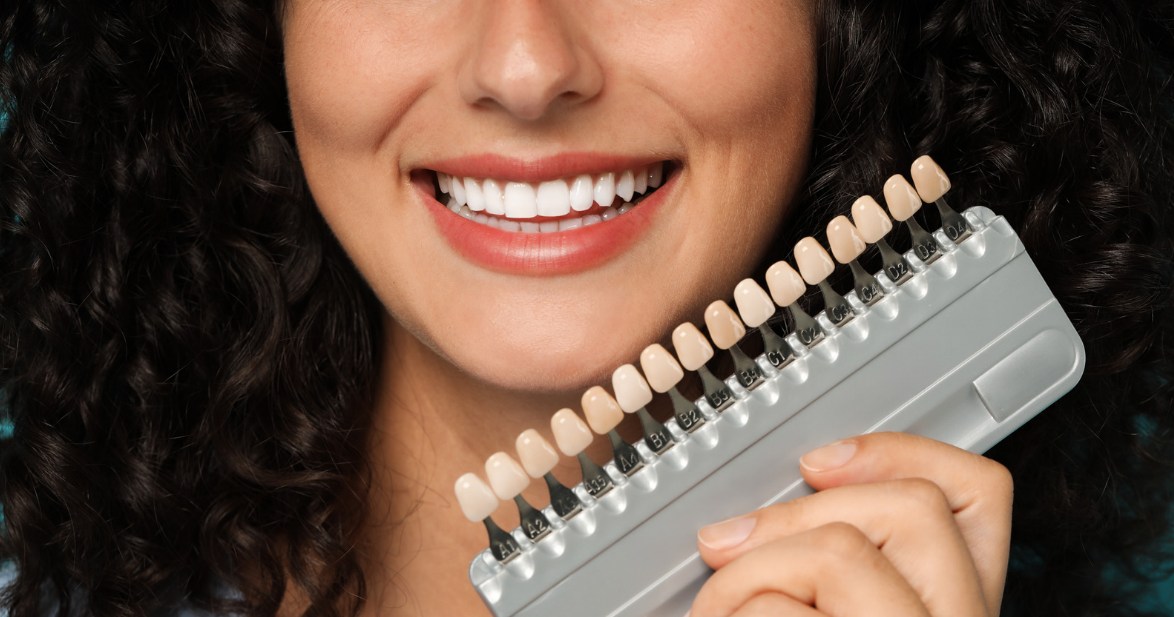 Veneers vs. Bonding: Which Cosmetic Solution Is Right for You? - A Guide by Mills Haven Dental